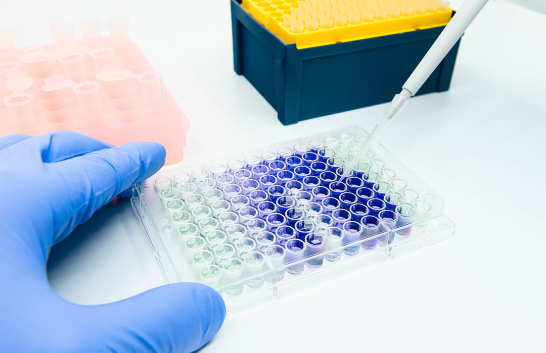 Plasma MMP-3: A Novel Biomarker Predicting ARDS Patient Outcomes