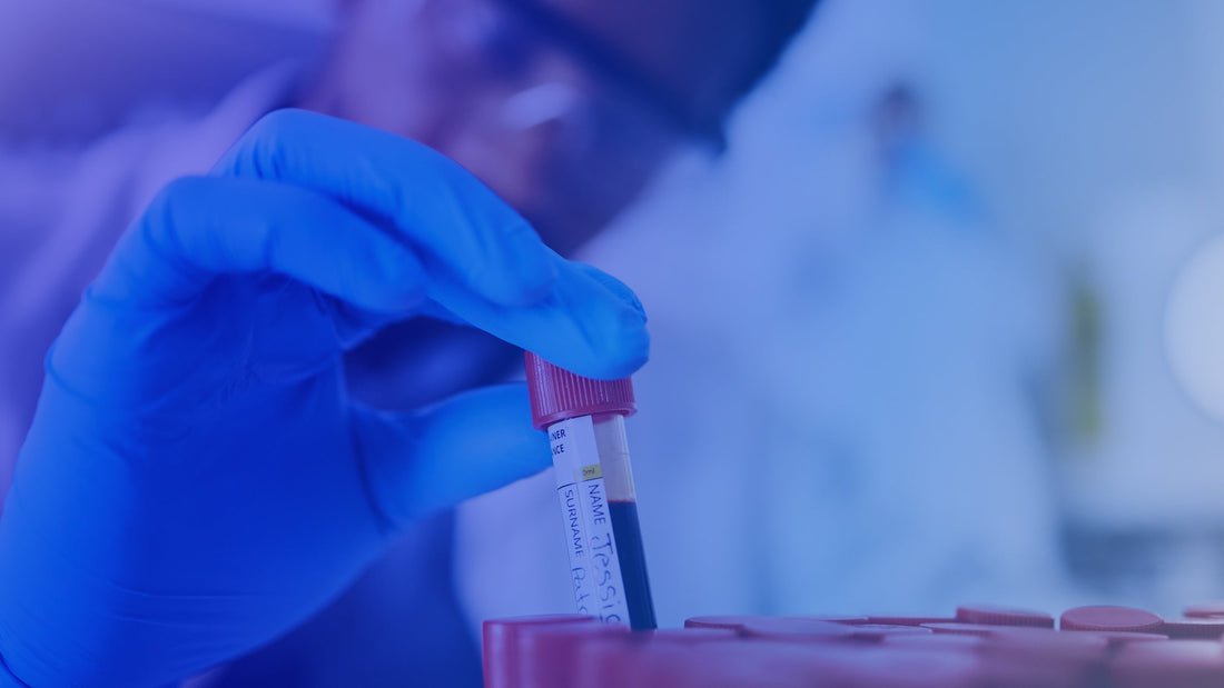 The Importance of Single Donor Blood Products in Research