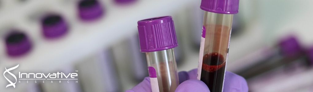 Microsampling with cotton thread: Storage and ultra-sensitive analysis by thread spray mass Spectrometry