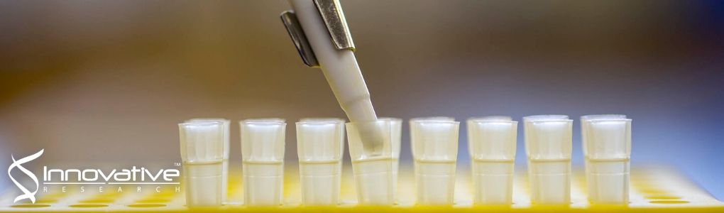 Platelet Factor 4 as a Novel Exosome Marker in MALDI-MS Analysis of Exosomes from Human Serum