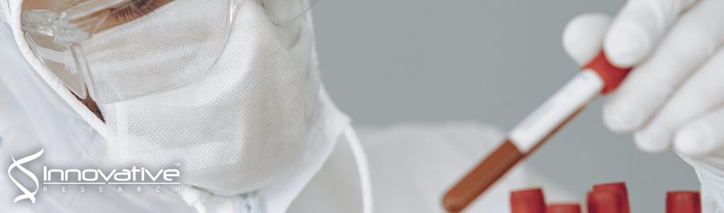 Dierential Dependency of Human Pancreatic Cancer Cells on Targeting PTEN via PLK 1 Expression