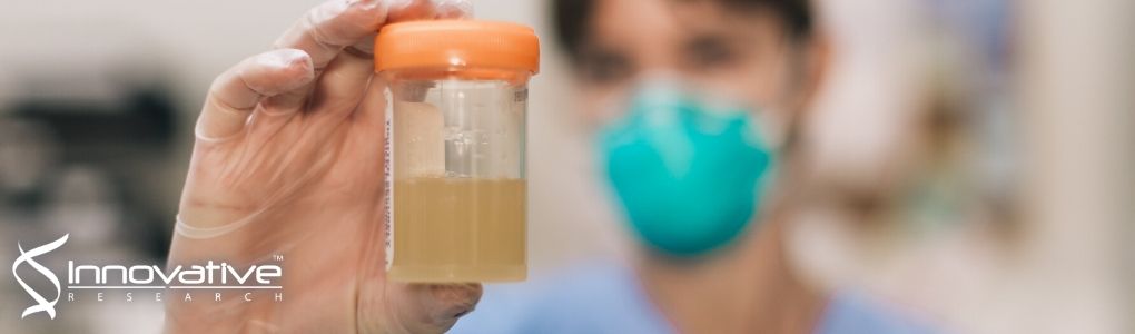 Determination of tafenoquine in human plasma by dispersive liquid‐liquid microextraction