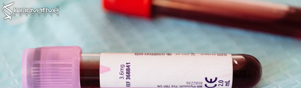 Old World Monkeys are Less than Ideal Transplantation Models for Testing Pig Organs Lacking Three Carbohydrate Antigens (Triple-Knockout)