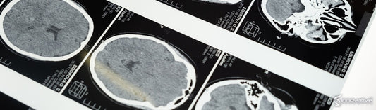 Poly (Ethylene Glycol)-Block-Poly (D, L-lactide) (PEG-PLA) Micelles for Brain Delivery of Baicalein through Nasal Route for Potential Treatment of Neurodegenerative Diseases due to Oxidative Stress and Inflammation: An in vitro and in vivo Study