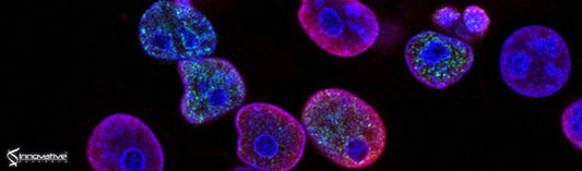 Effects of Inflammation and Soluble Epoxide Hydrolase Inhibition on Oxylipin Composition of Very Low‐Density Lipoproteins in Isolated Perfused Rat Livers