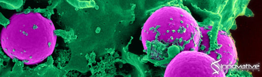 Iron Chelator Transmetalative Approach to Inhibit Human Ribonucleotide Reductase