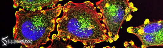 Wide-Targeted Metabolome Analysis Identifies Potential Biomarkers for Prognosis Prediction of Epithelial Ovarian Cancer