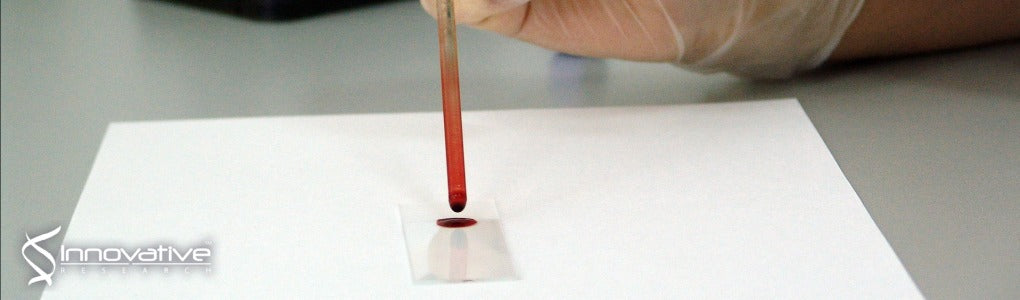 Characterization of Atherosclerotic Plaque Coating for Thrombosis Microfluidics Assays