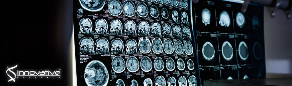 Factor VII Activating Protease (FSAP) Inhibits the Outcome of Ischemic Stroke in Mouse Models