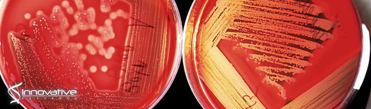 LC-MS/MS Method for Simultaneous Quantification of the First-Line Anti-Tuberculosis Drugs and Six Primary Metabolites in Patient Plasma: Implications for Therapeutic Drug Monitoring