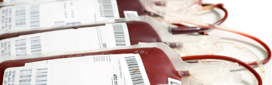 Which anticoagulant should I order with my purchase of blood or plasma?