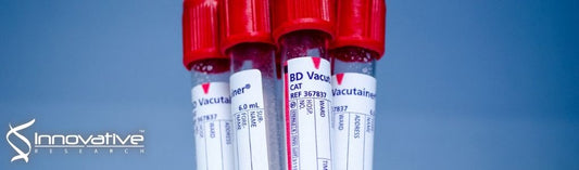 Two-level submicron high porosity membranes (2LHPM) for the capture and release of white blood cells (WBCs)