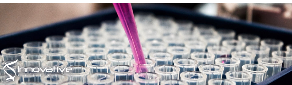 High-throughput epitope profiling of antibodies in the plasma of Alzheimer’s disease patients using random peptide microarrays