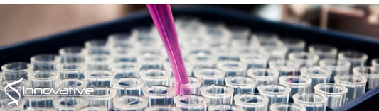 High-throughput epitope profiling of antibodies in the plasma of Alzheimer’s disease patients using random peptide microarrays