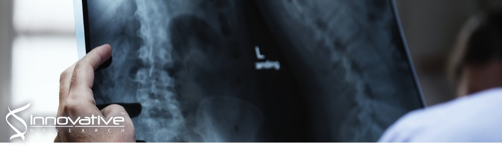 SELECTIVE ADSORPTION OF IGG TO DEPROTEINIZED BOVINE BONE MINERAL ENHANCES IL-10 EXPRESSION IN HUMAN PRIMARY MACROPHAGES