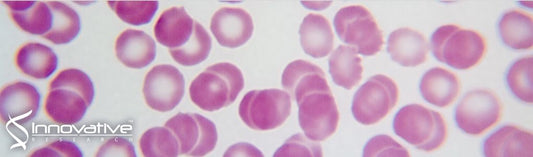 Cathelicidin Peptides Restrict Bacterial Growth via Membrane Perturbation and Induction of Reactive Oxygen Species