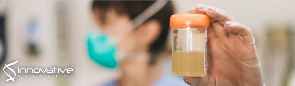 Solid-Phase Microextraction Enables Isolation of BRAF V600E Circulating Tumor DNA from Human Plasma for Detection with a Molecular Beacon Loop-Mediated Isothermal Amplification Assay