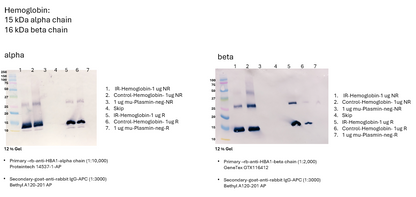 Human Hemoglobin Lyophilized