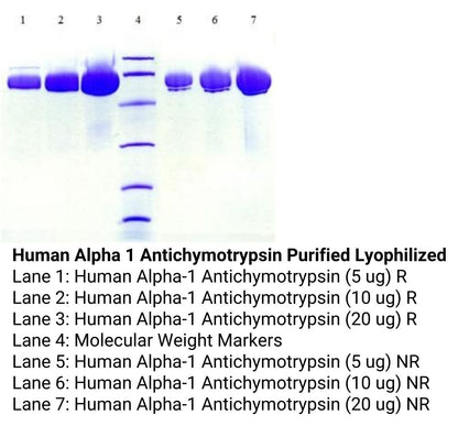 Human Alpha 1 Antichymotrypsin Purified Lyophilized