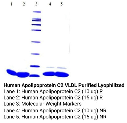 Human Apolipoprotein C2 VLDL Purified Lyophilized