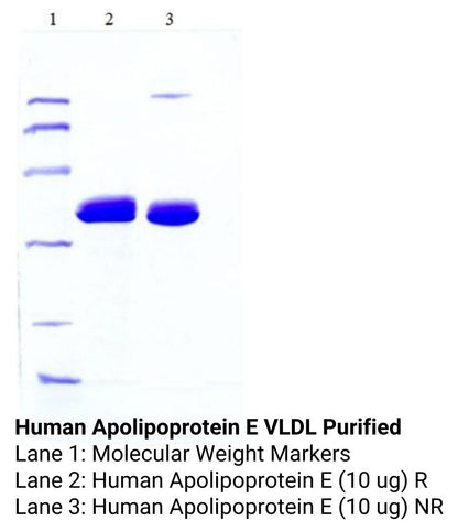 Human Apolipoprotein E VLDL Purified