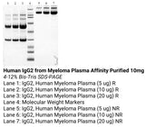 Human IgG2 from Myeloma Plasma Affinity Purified