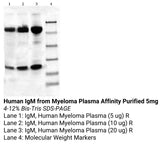 *Human IgM from Myeloma Plasma Affinity Purified