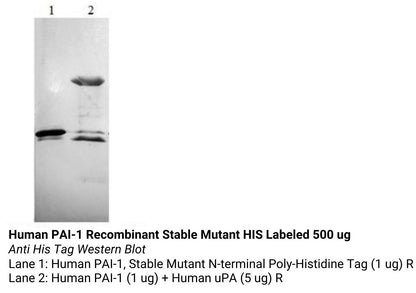 *Human Pai 1 Recombinant Stable Mutant His Labeled