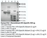 *Human Pai 1 Recombinant tPA Specific