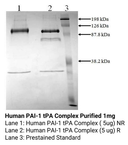 *Human PAI-1 tPA Complex Purified