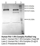 *Human PAI-1 tPA Complex Purified