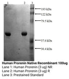 *Human Prorenin Native Recombinant
