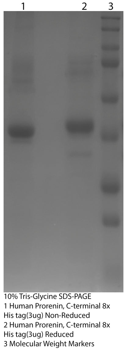 *Human Renin Purified C-Terminal 8X-Histidine Tag