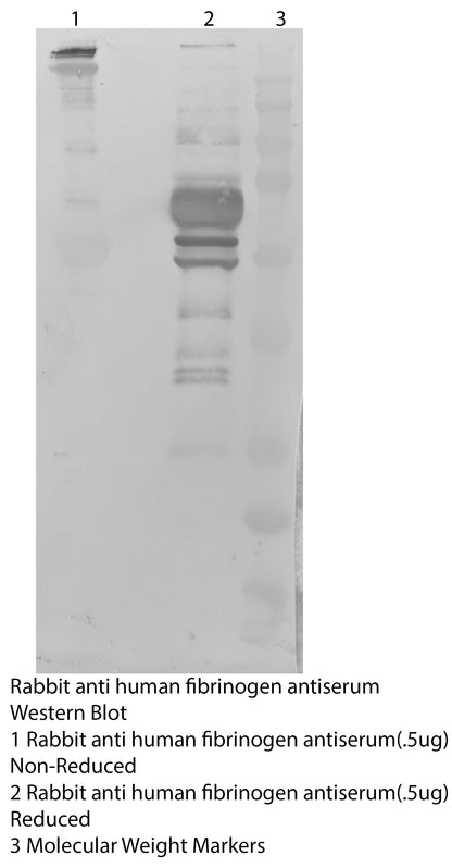 *Rabbit Anti Human Fibrinogen Polyclonal Fractionated