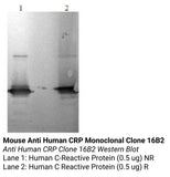 *Mouse Anti Human CRP Monoclonal Clone 16B2