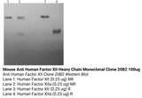 *Mouse Anti Human Factor XII Heavy Chain Monoclonal Clone 20B2