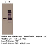 *Mouse Anti Human PAI-1 Monoclonal Clone 3A120