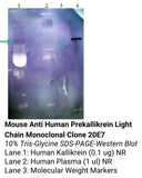 *Mouse Anti Human Prekallikrein Light Chain Monoclonal Clone 20E7