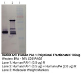 *Rabbit Anti Human PAI-1 Polyclonal Fractionated