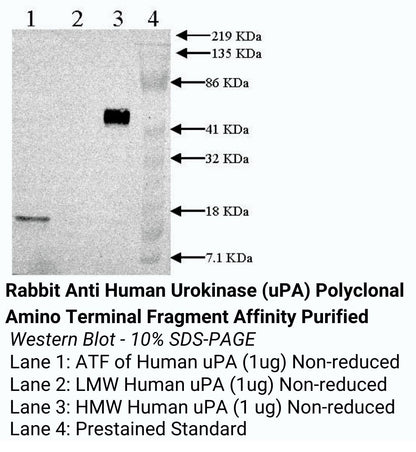 *Rabbit Anti Human Urokinase (uPA) Polyclonal Amino Terminal Fragment Affinity Purified