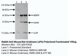 *Rabbit Anti Human Urokinase (uPA) Polyclonal Fractionated