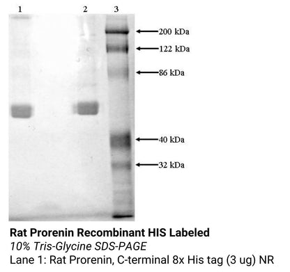 *Rat Prorenin Recombinant HIS Labeled